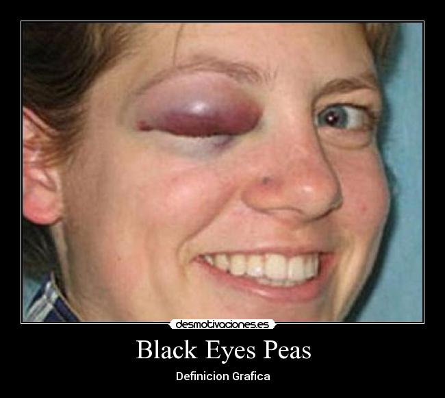 Black Eyes Peas - 