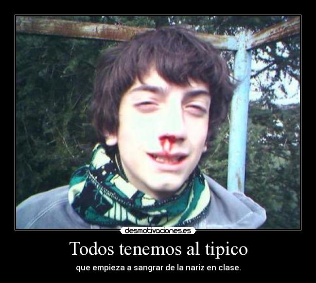 Todos tenemos al tipico -