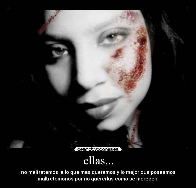 ellas... - no maltratemos  a lo que mas queremos y lo mejor que poseemos
maltretemonos por no quererlas como se merecen 