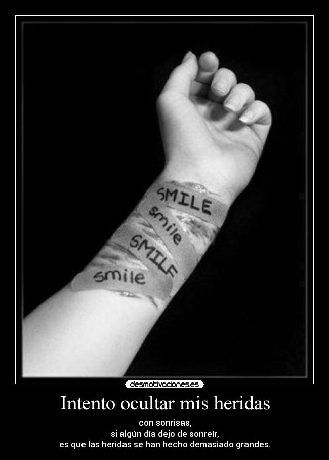 Intento ocultar mis heridas -