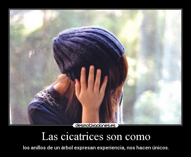 Las cicatrices son como - los anillos de un árbol expresan experiencia, nos hacen únicos.