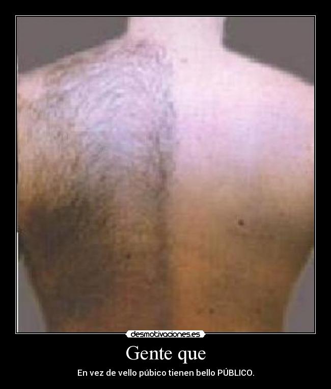 Gente que - En vez de vello púbico tienen bello PÚBLICO.