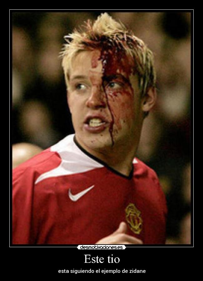 Este tio - esta siguiendo el ejemplo de zidane