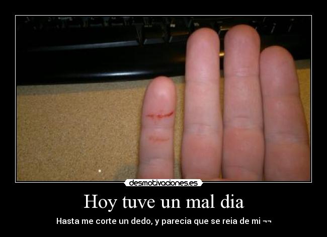 Hoy tuve un mal dia - Hasta me corte un dedo, y parecia que se reia de mi ¬¬