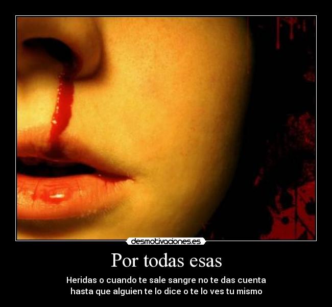 Por todas esas - Heridas o cuando te sale sangre no te das cuenta
hasta que alguien te lo dice o te lo ves tu mismo