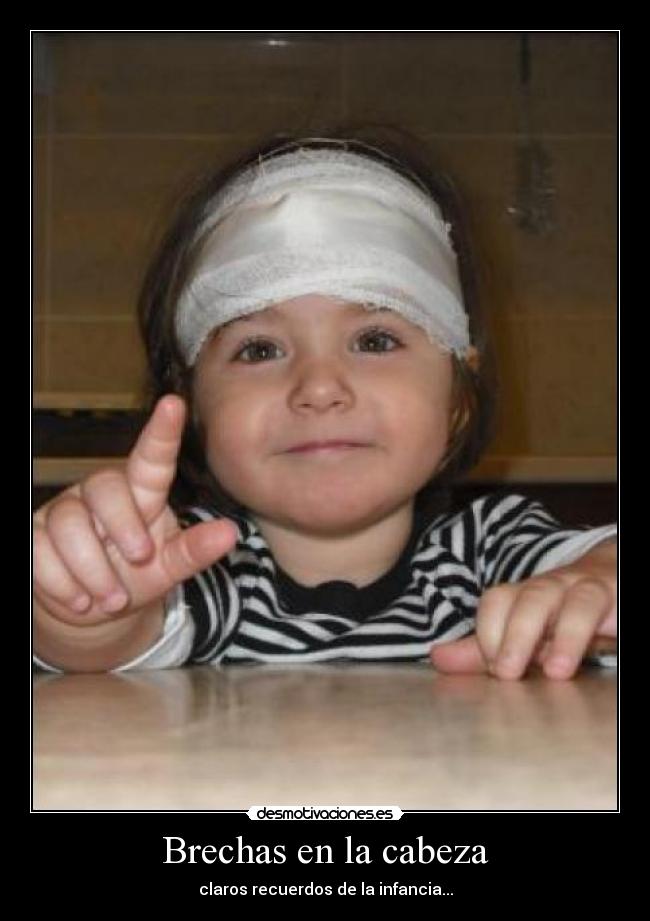Brechas en la cabeza -