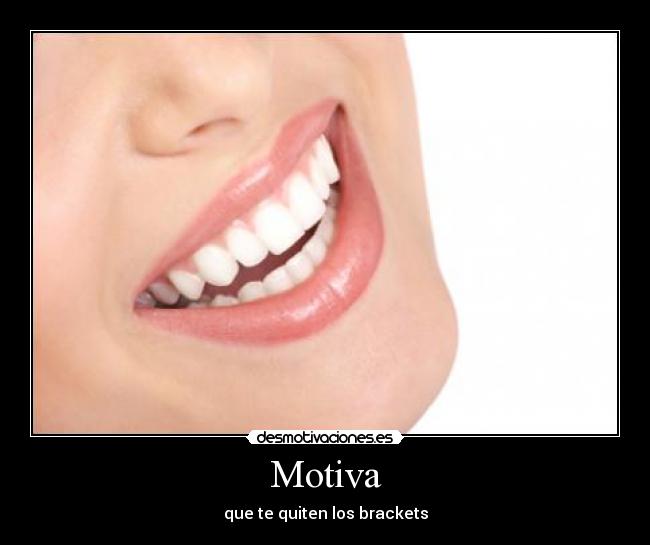 Motiva - 