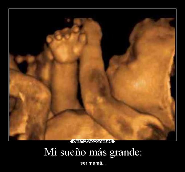 Mi sueño más grande: - ser mamá...