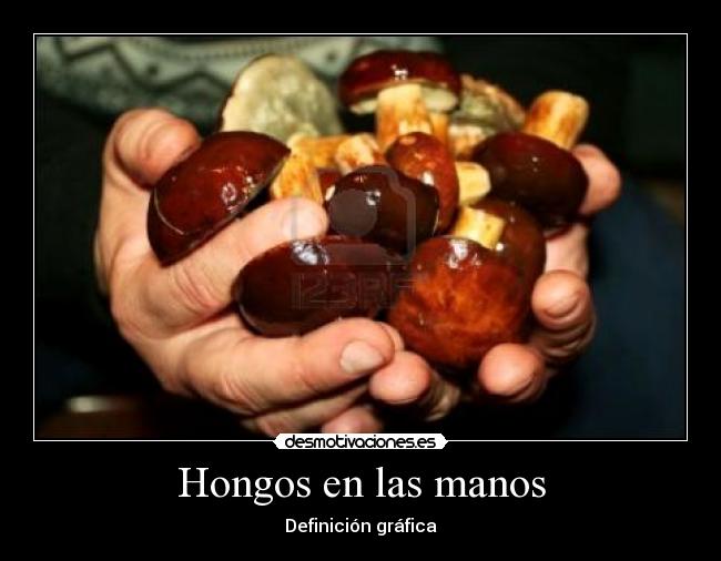 Hongos en las manos -