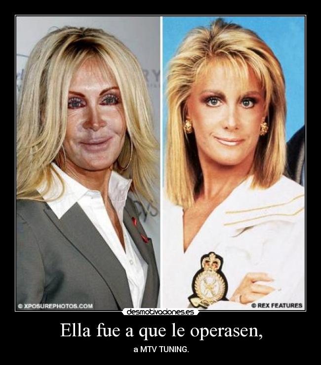 Ella fue a que le operasen, - a MTV TUNING.
