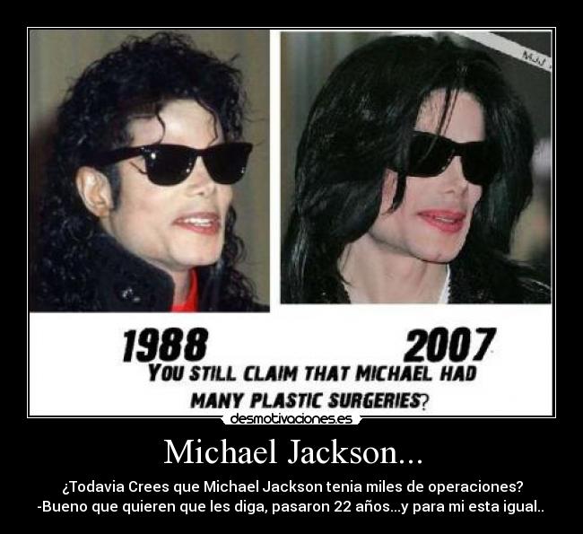 Michael Jackson... - ¿Todavia Crees que Michael Jackson tenia miles de operaciones?
-Bueno que quieren que les diga, pasaron 22 años...y para mi esta igual.. 