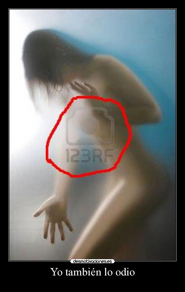 Yo también lo odio -