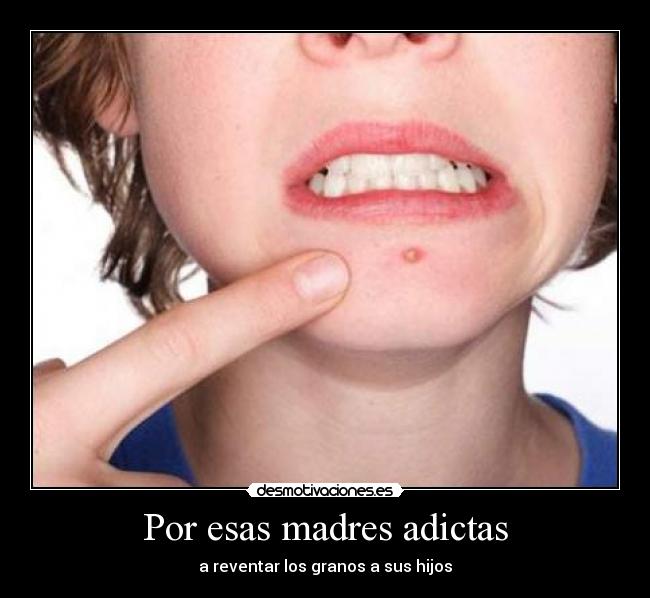 Por esas madres adictas - 