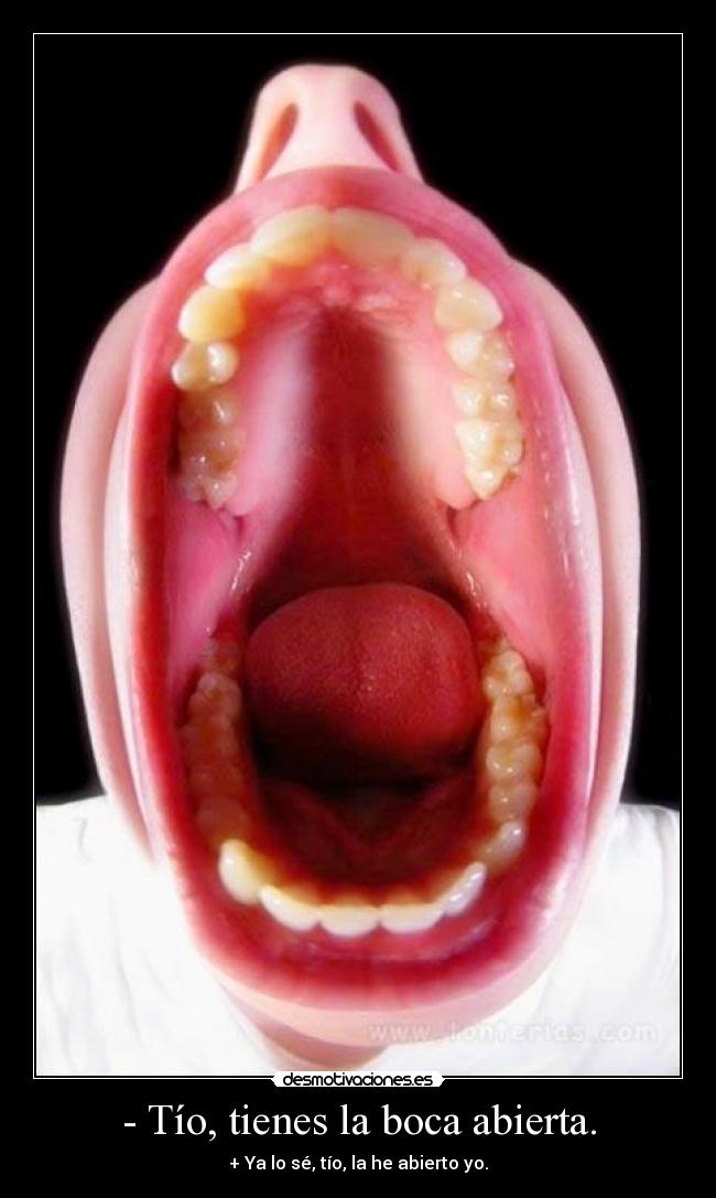 - Tío, tienes la boca abierta. - + Ya lo sé, tío, la he abierto yo.