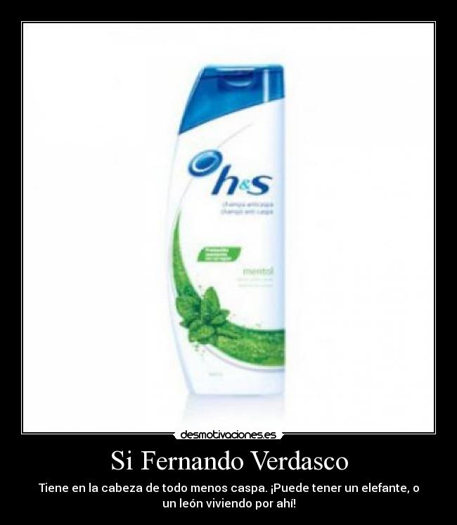 Si Fernando Verdasco - Tiene en la cabeza de todo menos caspa. ¡Puede tener un elefante, o
un león viviendo por ahí!