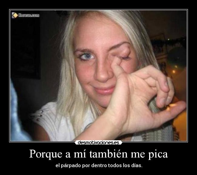 Porque a mí también me pica - 