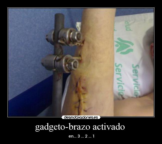 gadgeto-brazo activado  - 