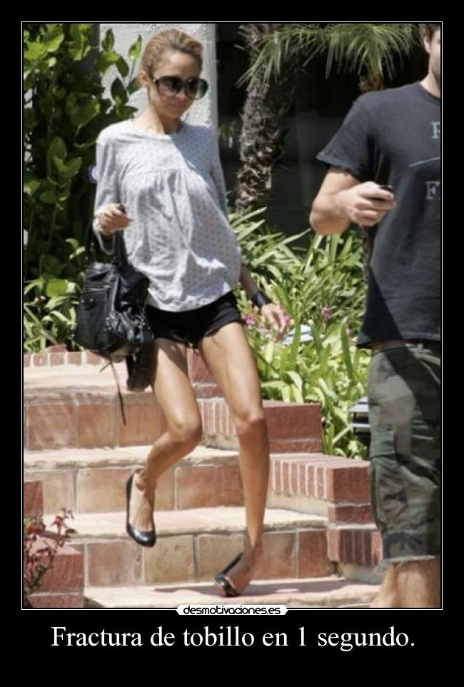 carteles fractura tobillo desmotivaciones
