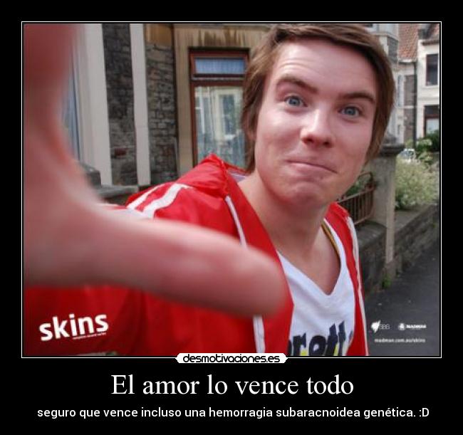 El amor lo vence todo -  seguro que vence incluso una hemorragia subaracnoidea genética. :D