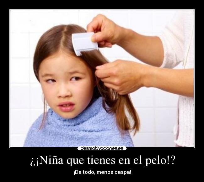 ¿¡Niña que tienes en el pelo!? - 