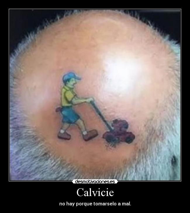 Calvicie - no hay porque tomarselo a mal.