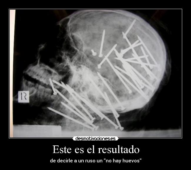 Este es el resultado - 