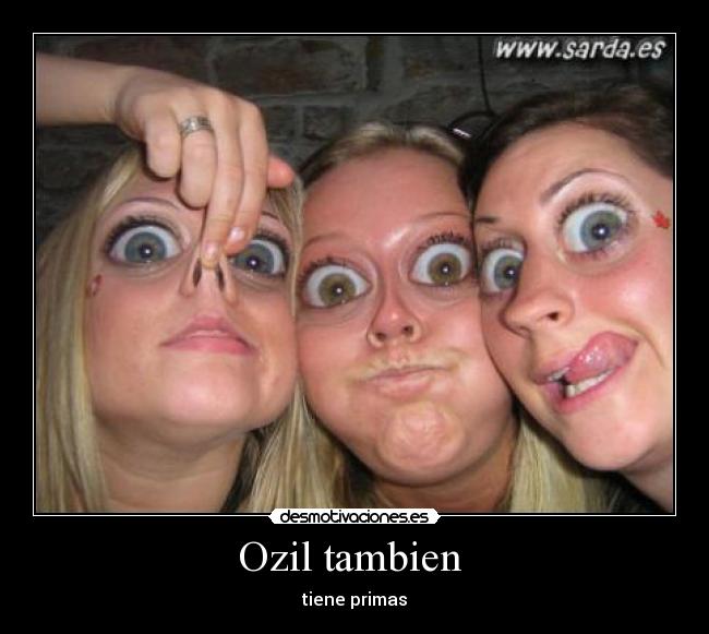Ozil tambien - tiene primas