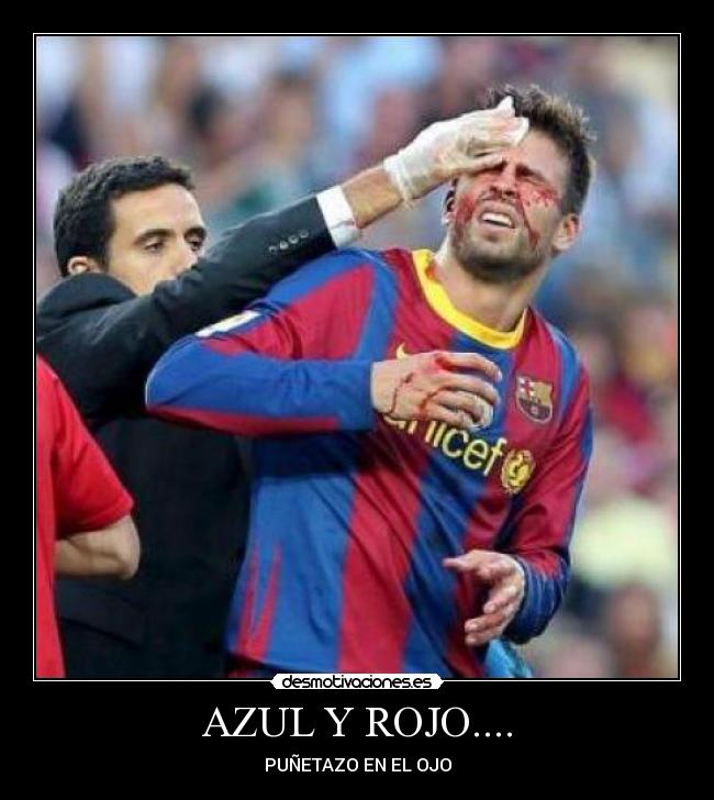 AZUL Y ROJO.... - PUÑETAZO EN EL OJO