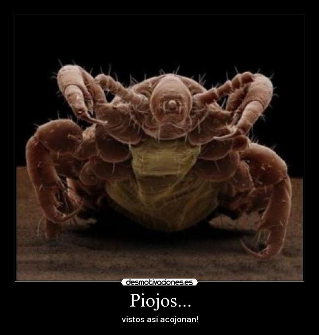 Piojos... - vistos asi acojonan!
