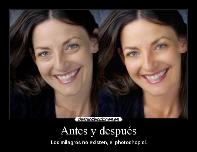 Antes y después - 