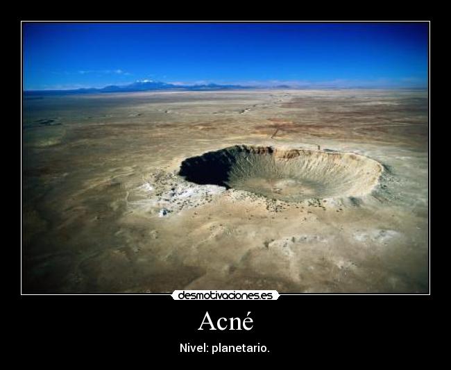 carteles acne desmotivaciones