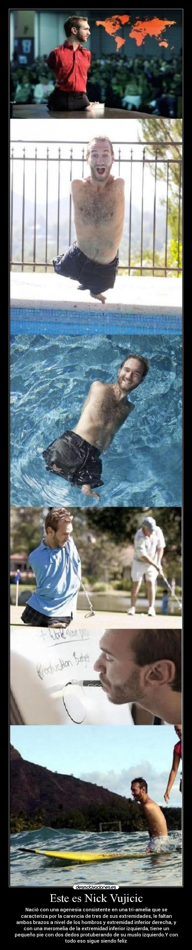 Este es Nick Vujicic -