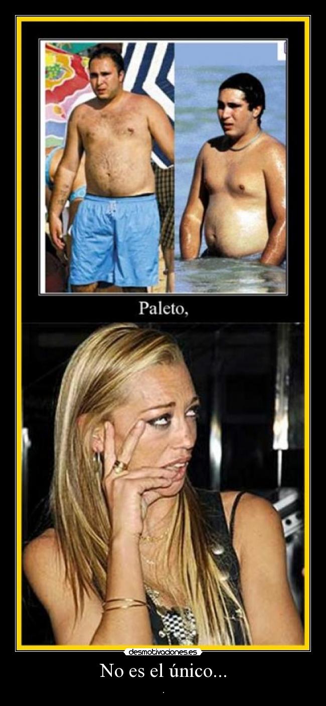 No es el único... -