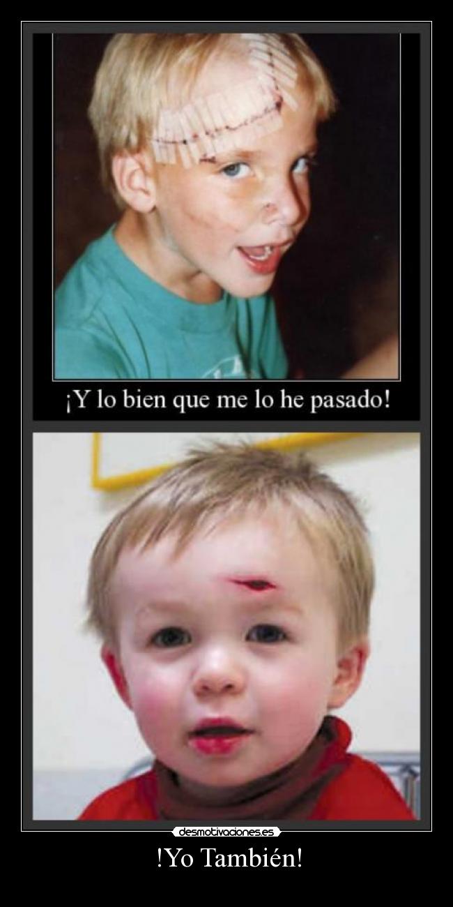 !Yo También! -