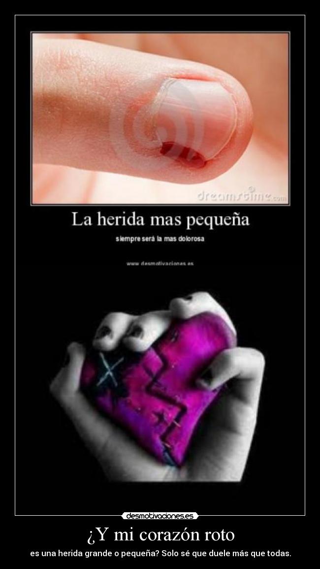 ¿Y mi corazón roto - 