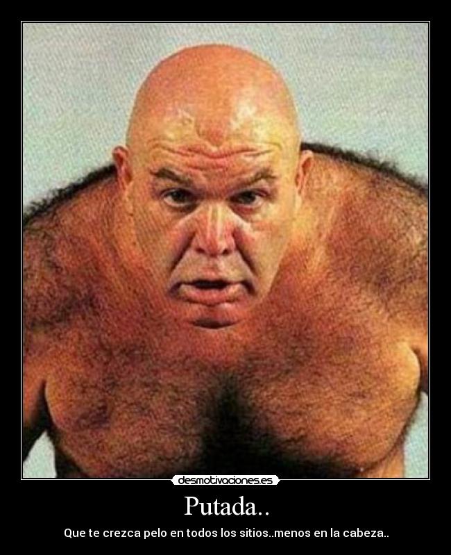 Putada.. - Que te crezca pelo en todos los sitios..menos en la cabeza..