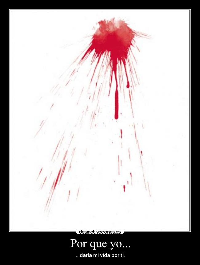 Por que yo... -