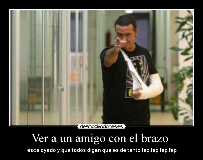 Ver a un amigo con el brazo - escaloyado y que todos digan que es de tanto fap fap fap fap
