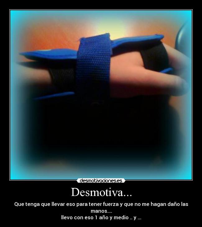 Desmotiva... - Que tenga que llevar eso para tener fuerza y que no me hagan daño las manos....
llevo con eso 1 año y medio .. y ...