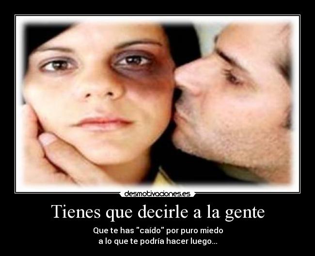 Tienes que decirle a la gente - Que te has caído por puro miedo
a lo que te podría hacer luego...