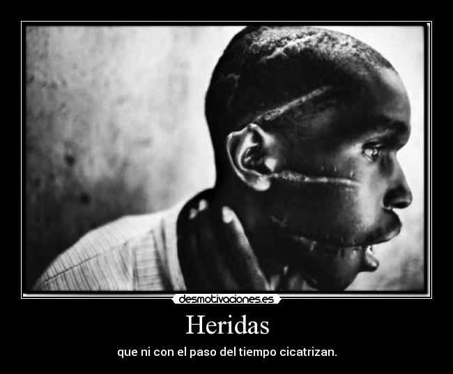 Heridas -