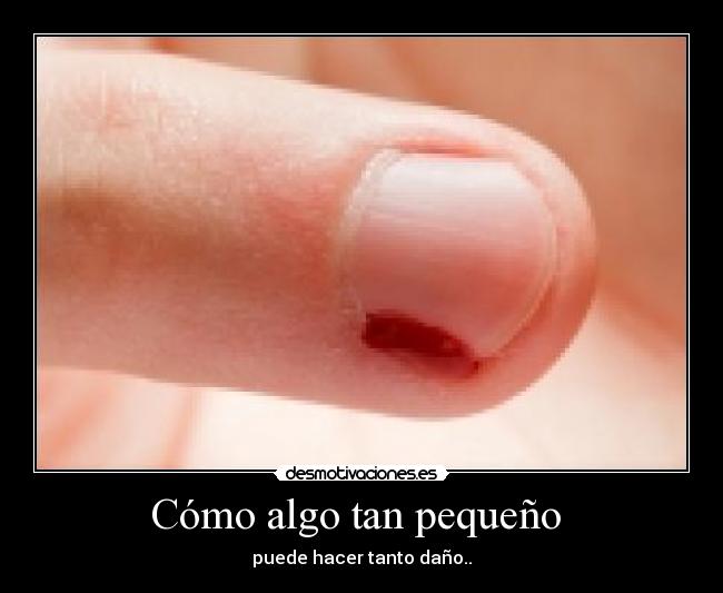 Cómo algo tan pequeño  - 