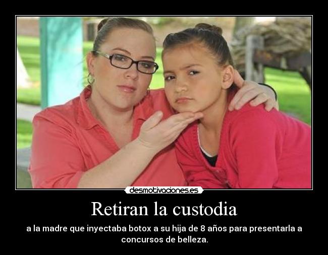 Retiran la custodia - a la madre que inyectaba botox a su hija de 8 años para presentarla a
concursos de belleza.