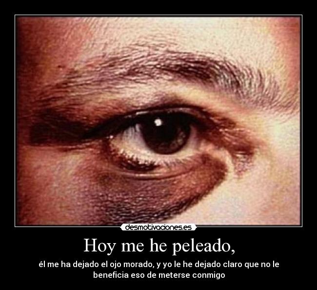 Hoy me he peleado, - él me ha dejado el ojo morado, y yo le he dejado claro que no le
beneficia eso de meterse conmigo