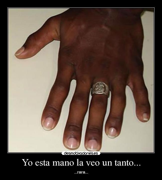 Yo esta mano la veo un tanto... - ...rara...