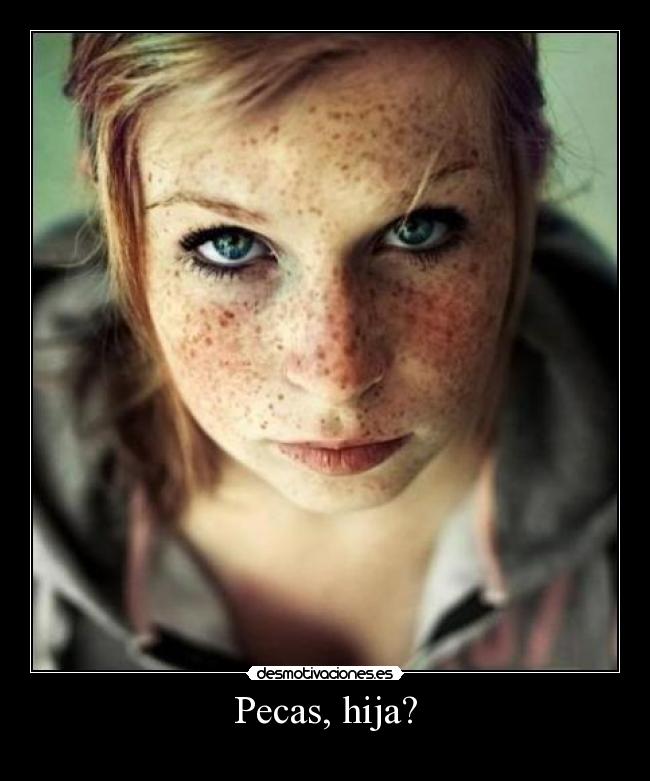 Pecas, hija? -