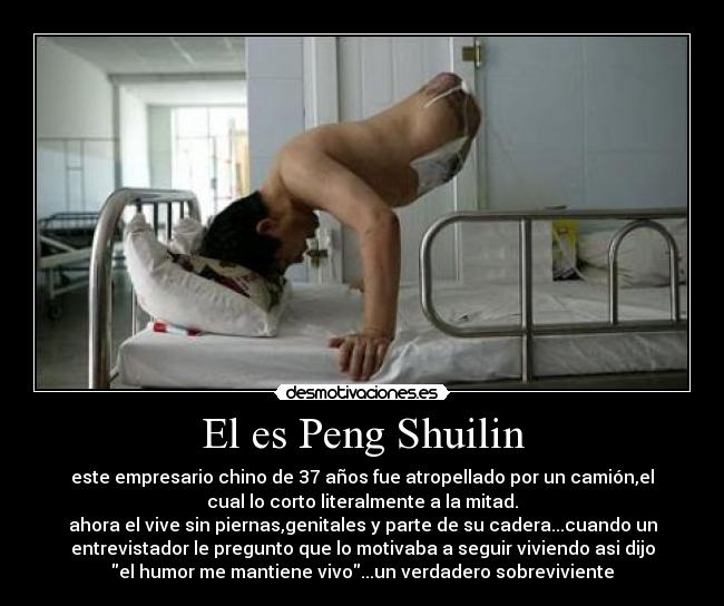 El es Peng Shuilin - este empresario chino de 37 años fue atropellado por un camión,el
cual lo corto literalmente a la mitad.
ahora el vive sin piernas,genitales y parte de su cadera...cuando un
entrevistador le pregunto que lo motivaba a seguir viviendo asi dijo
el humor me mantiene vivo...un verdadero sobreviviente