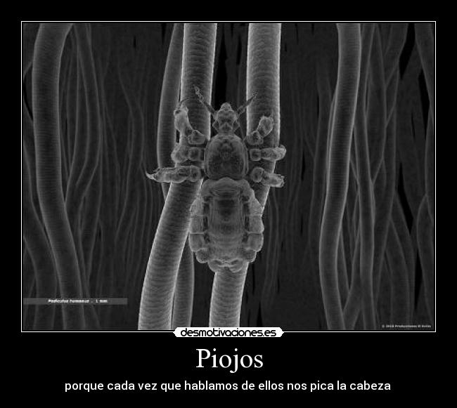 Piojos -