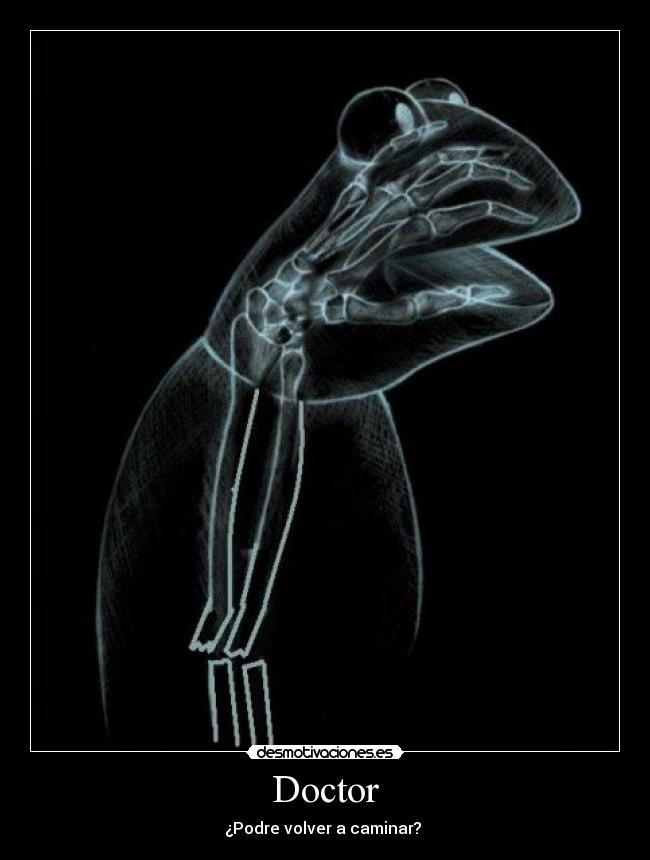Doctor - ¿Podre volver a caminar?