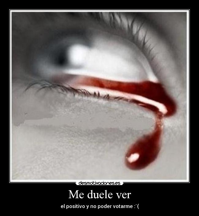 Me duele ver - el positivo y no poder votarme :´(